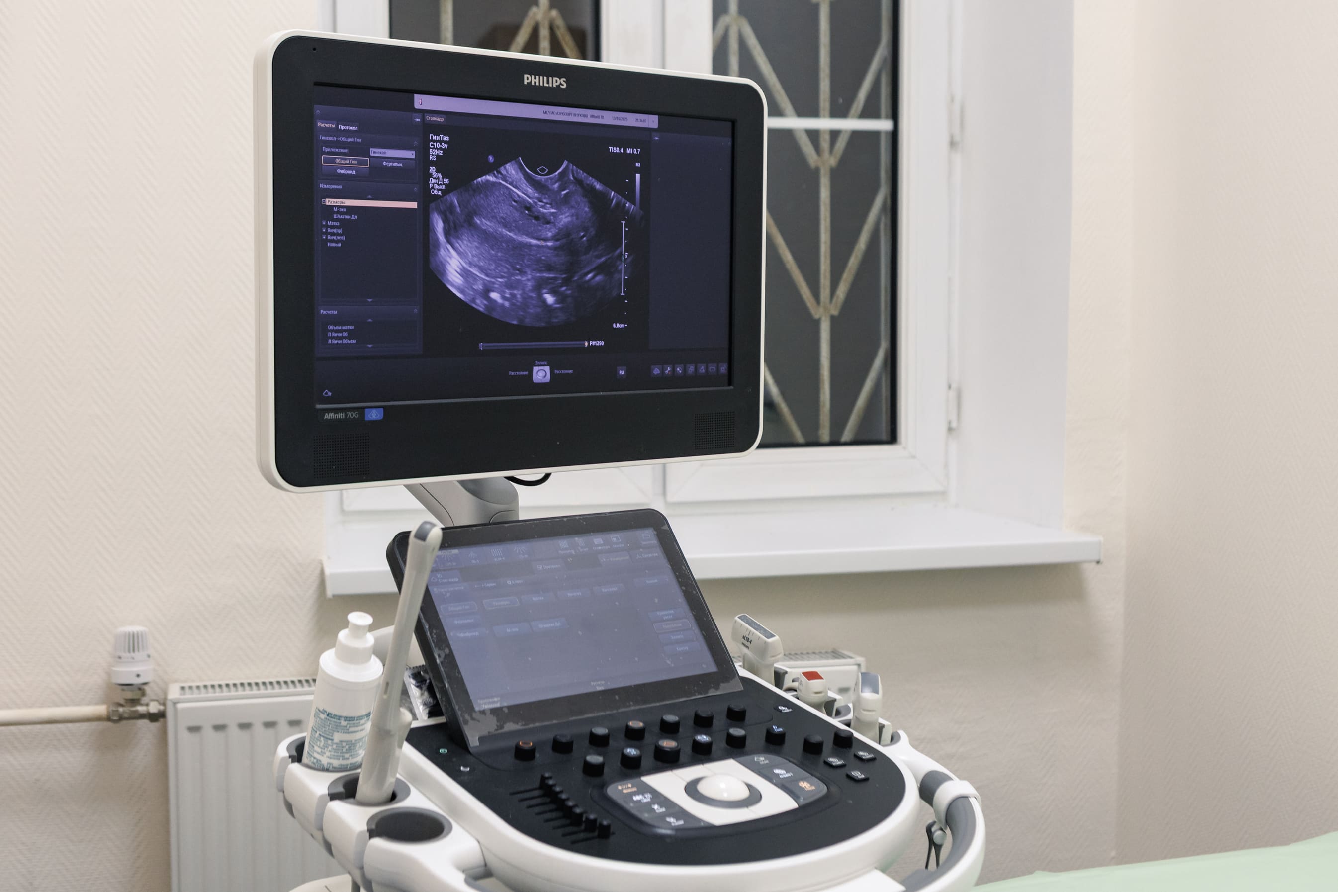 Ультразвуковая диагностика